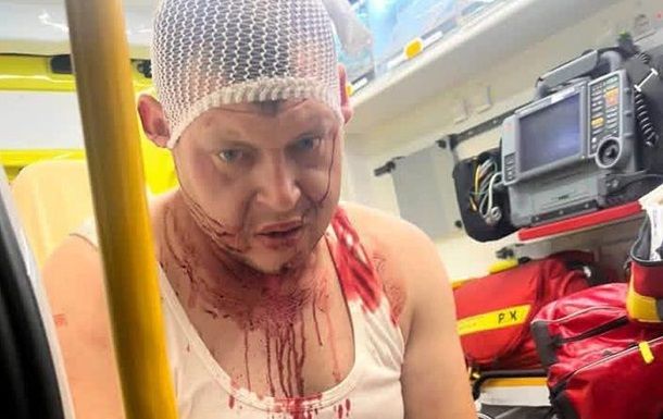 Нападение на украинцев зафиксировано в польском городе Кожухув
